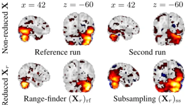 Fig. 2. Median aligned maps with various methods; HCP dataset;