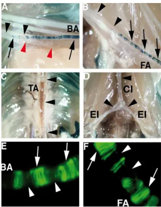 Fig. 1. Pax3 is expressed in peripheral arteries of adult mice. The expression of Pax3 was analyzed in adult Pax3 nlacZ/+ mice after X-gal staining and in Pax3 GFP/+ mice by direct observation of GFP fluorescence after dissection to expose the underlying t