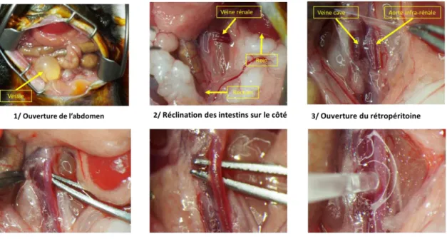 Figure 4 : Images illustrant les étapes techniques pour réaliser l’application d’élastase au niveau  de l’adventice de l’aorte abdominale sous -rénale  
