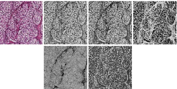 Figure 3: Color deconvolution. (Top row) Vascular network (V channel): (from left to right) RGB image, red channel, blue channel, V channel.