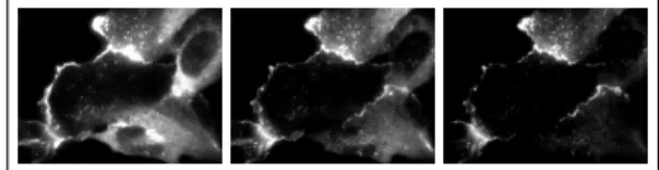 Figure 1 contains an example of MA-TIRFM acquisitions from a sample of cortactin. It is readily seen from these images that when the penetration depth decreases (from left to right), some  flu-orophores are not excited anymore