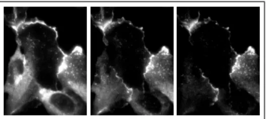 Figure 1 contains an example of MA-TIRFM from a sample of cortactin. It is readily seen from these images that when the  pen-etration depth decreases (from left to right), some fluorophores are not excited anymore