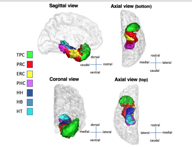 FIGURE 2 | Medial temporal lobe structures in sagittal, coronal, and axial views. The structures presented here are computed over the whole population and converted to surfaces with BrainVisa’s AimsMesh function