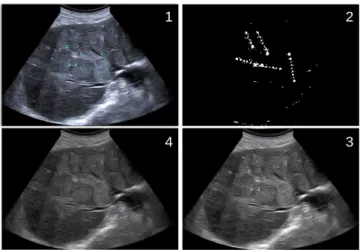 Fig. 6: (Left) Example of the label ’Poor detection’, a part of the fan is not detected because it is filled with low intensity pixels