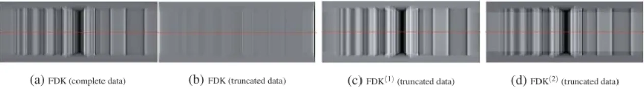 Figure 4. Comparison of one projection of the 3D sinogram ﬁltered by the three described algorithms where FDK (1) and FDK (2) correspond to FDK based on the ﬁrst derivative operator and the 1D Laplace operator, respectively.
