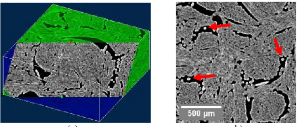 Fig. 4. ASDIR reconstruction of the SN1 sample: (a) oblique cut through the volume; (b) cropped  CT slice inside the ROI