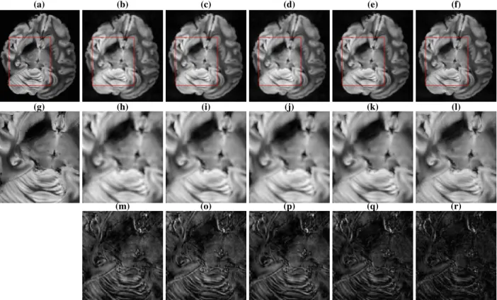 Fig. 1. (a) Cartesian reference. (b) Reconstruction with no regularization term. (c) Reconstruction based on the group-LASSO penalty.