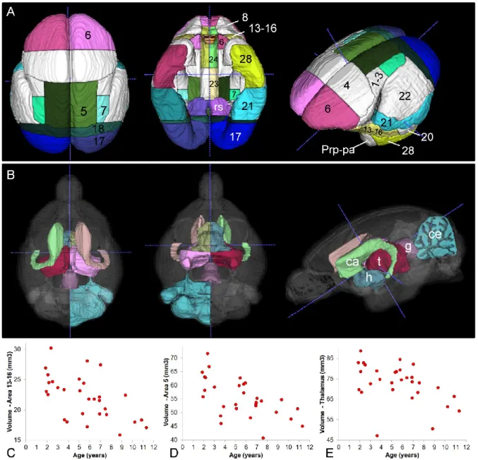Figure  4.  Age-related  evolution  of  cerebral  atrophy  in  various  brain  regions