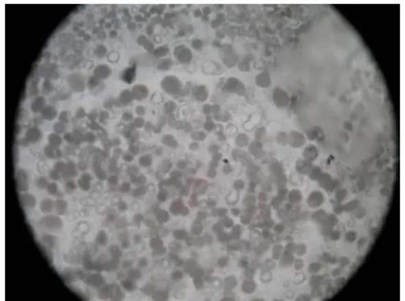 Figure 6 – Picture of the glassy sample observed after decompression from 850°C-0.3 GPa,   Evidencing of the vesiculation process (diameter of bubbles about 50 µm) 