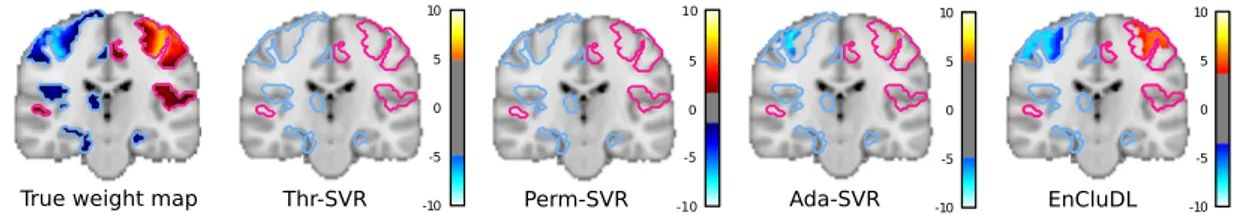 Figure 4: Qualitative comparison of the model solutions. Here, we show the solutions (z-maps) given by the four inference procedures, for a single random draw of the noise vector in the experiment described in Sec