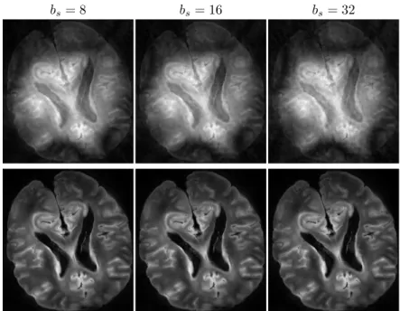 Figure 8: Online reconstruction of 8-fold (S = 64 shots) prospectively accelerated Sparkling scan of ex vivo human brain in a multi-channel coil acquisition setup