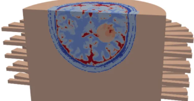 Fig. 9. Imaginary part of the relative complex permittivity of  the virtual head model immersed in the imaging chamber with  a simulated ellipsoid-shaped hemorrhagic stroke