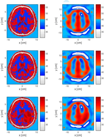 Fig.  11.  Transverse  cross-section  of  the  virtual  brain  during  the  evolution  of  a  simulated  hemorrhagic  stroke:  imaginary  part  of  the  relative  permittivity