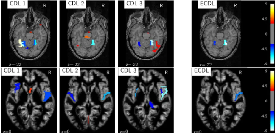 Fig. 5. Results of the CDL and ECDL algorithms on Haxby (top) and Oasis (bottom) experiments