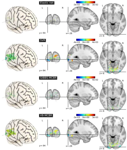 Fig. 6. Inter-subject analysis. Maps of weights found by the different methods on the 2500 most relevant features by Anova