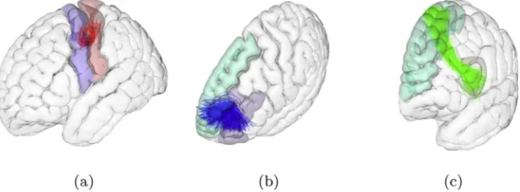 Fig. 1. SWM bundles of ﬁ bers connecting different gyri of the left frontal region. These structures can connect adjacent gyri (showing their characteristic close U- U-shape) or skip one or more sulci (open U-U-shape)