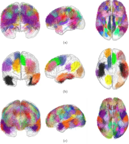 Fig. 4. A: Bundles connecting pre and postcentral gyri in the atlas1 (PoC-PrC 0,1,2 and 3)