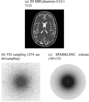 Fig. 2: True MR image and non-uniform k-space data used to benchmark algorithms.