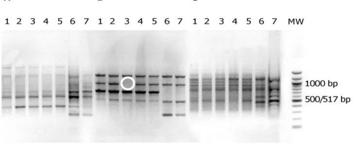 Figure 1. Electrophoretic patterns in agarose gel of PCR products from E. coli isolates