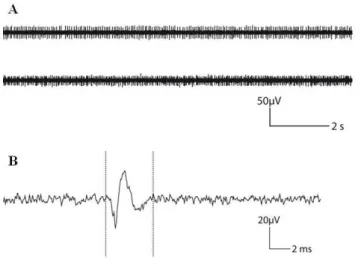 Fig. 9. Spontaneous activity of a retina recorded with a 8×8 matrix  diamond MEA: (A) trace recorded during 10s, (B) typical shape of a 