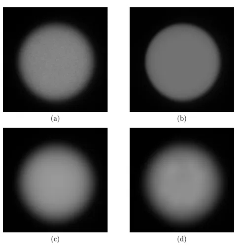 Figure 12: Restoration of a bead. (a) is the original image, (b) is the result obtained with the TV prior, (c) is the result obtained with the proposed prior and (d) is the result obtained with the Curvelets prior.