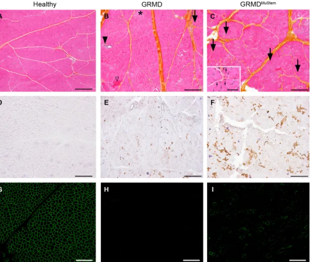 Fig 2. Histological analysis of the Biceps femoris muscle of 9-month old dogs. Healthy (#3H), GRMD (#6G), and GRMD MuStem (#7G Mu ) dog muscles are presented respectively in left, mid and right panel