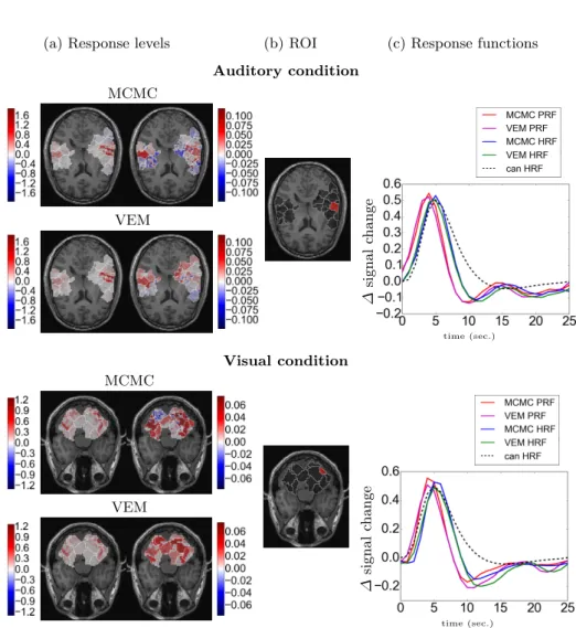 Fig. 4. Results on real fASL data for a single subject of the AINSI database for both conditions: Auditory (top) and Visual (bottom)