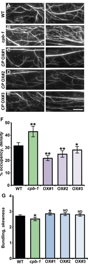FiguRE 4:  CP levels affect cortical actin organization in hypocotyl  epidermal cells