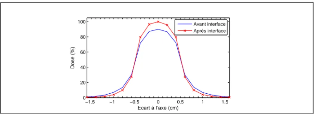 Fig. 3: Profils de dose d’un faisceau fin, avant et après l’interface eau/os.