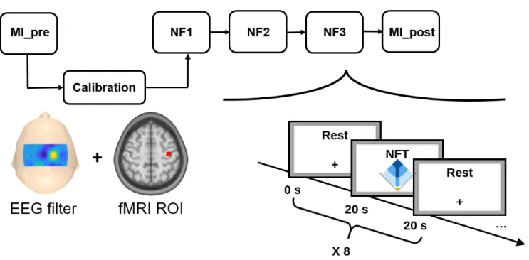 Figure 3. The experimental protocol consisted of 5 EEG-fMRI runs: a preliminary motor imagery run without NF (MI pre) used for calibration, three NF runs (NF1, NF2, NF3), and a post motor imagery run without NF (MI post)