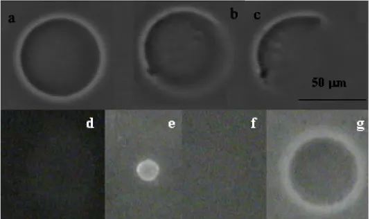 Figure 2. Attack of a vesicle by a detergent (Decon). Vesicle filled with a PolyNipam solution observed by Phase contrast microscopy: 1a: initial state, 1b-1c: the membrane is broken and the vesicle progressively vanishes; gel-filled vesicle  (MBA concentr