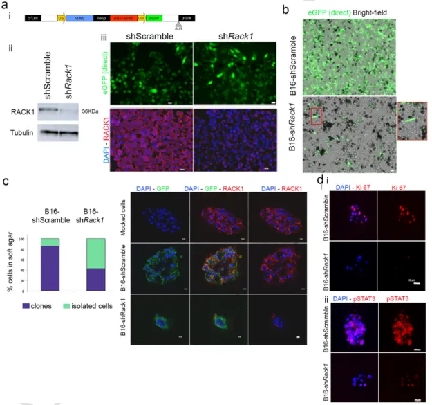 Fig. 1. RACK1 knock-down reduced B16 melanoma cells invasiveness and led to cell differentiation.a: i Lentiviral vector backbone for shRNA expression with GFP control of transduction;