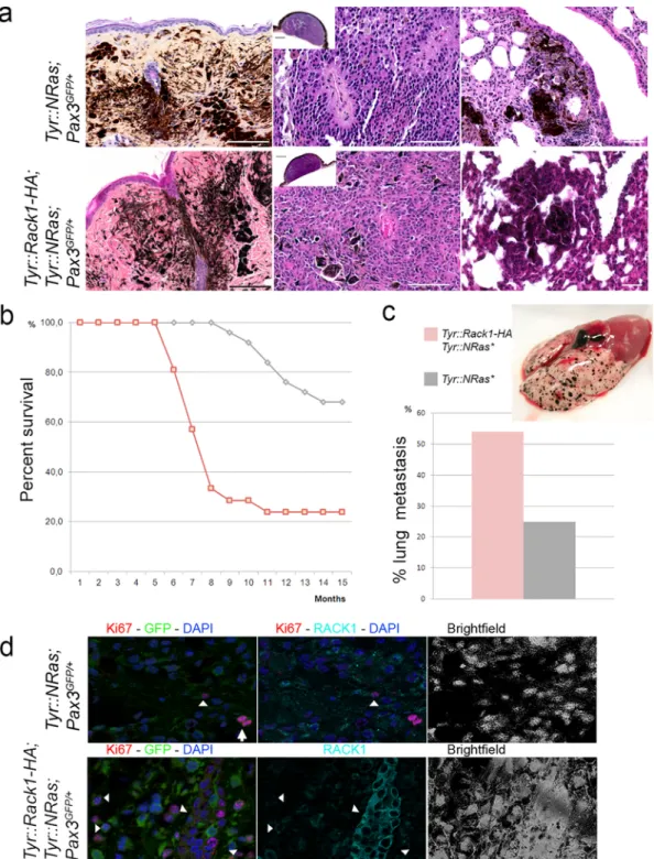 Fig. 4. Targeted RACK1 overexpression reduces latency and increases incidence of melanoma development in Tyr::NRas ⁠⁎ mice.a, Histological features (haematoxylin-eosin-saffron staining) of melanocytic nevi, primary cutaneous melanoma and lung metastases in