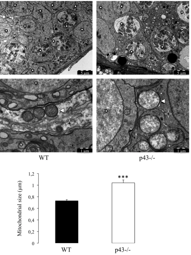 Figure 6. The mitochondrial morphology is strongly affected in Sertoli cells of p432/2 mice