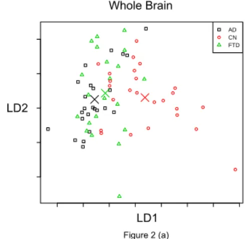 Table 1: logistical regression classification using Freesurfer and complexity metrics