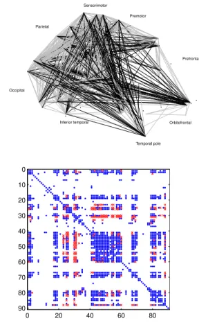 Fig. 1. Top: Anatomical representation of the 700 selected connec- connec-tions where short, < 7.5cm, (resp