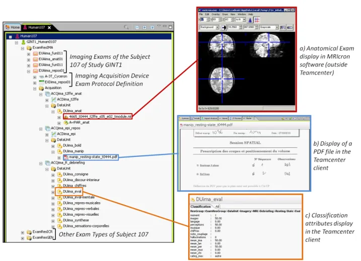 Figure 3 Screenshot of Teamcenter rich client window. The items under the subject 107 belonging to the study GINT1 are displayed; a brain imaging resting-state exam is partially expanded and two datasets are opened: an anatomical image (a) and a pdf file (