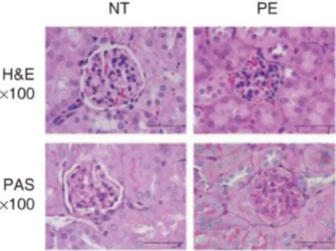 Figure  14:  Histological  kidney  sections.  Histological  kidney  sections  stained  with  haematoxylin and eosin (upper panel) and with periodic acid Schiff (lower panel)