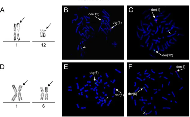 Figure 1. Chromosomal region 1p32 anomalies and genic rearrange- rearrange-ments in lipoma cases 3 (A–C) and 16 (D–F)