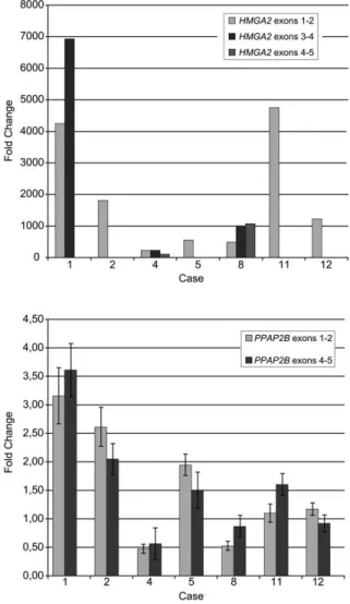 Figure 4. Expression patterns of exons 1–2, exons 3–4, and exons 4–5 of HMGA2 (A) and exons 1–2 and exons 4–5 of PPAP2B (B) using qRT-PCR in seven lipomas with t(1;12)(p32;q14.3)