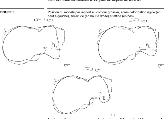 FIGURE 8. Position du modèle par rapport au contour grossier, après déformation rigide (en haut à gauche), similitude (en haut à droite) et affine (en bas).