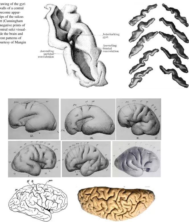 Fig. 1    Left: drawing of the gyri  buried in the walls of a central  sulcus which become  appar-ent when the lips of the sulcus  are drawn apart (Cunningham  1903)