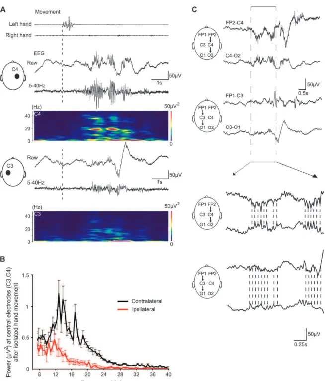 Figure 3. Contralateral dominance of the hand movement--associated cortical C3/C4 delta-brushes