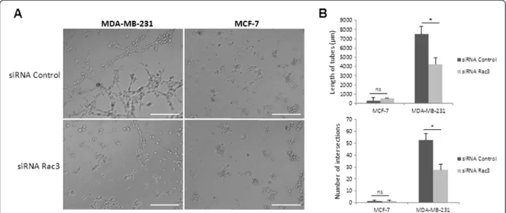 Figure 3 Effect of Rac3 inhibition on vasculogenic mimicry on growth-factor-rich Matrigel