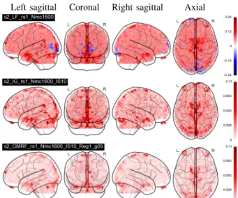 Fig. 1. Resting state (−c 2 )-maps estimated from the LF, IG and GaMRF procedures (top to bottom).