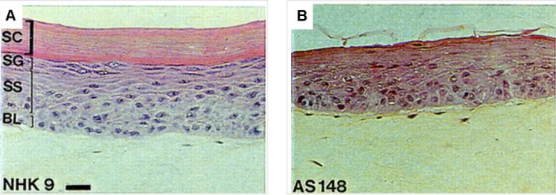 Figure  33  XP-C  fibroblasts  provoke  epidermal  invasions  in  organotypic  skin  cultures