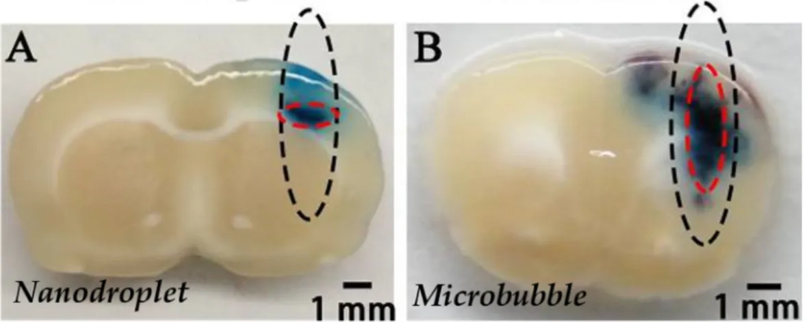 Figure 5. Distribution pattern of Evans blue extravasation when PEG-PLGA-C 5 F 12  nanodroplets (A)  or lipid microbubbles (B) were used for BBB opening with FUS on male Sprague-Dawley rats