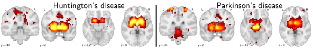 Fig. 4: regression coefficients for “left amygdala”, “amygdala”, and “right amygdala”