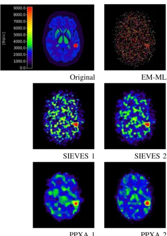 Fig. 1. Reconstructed images (in Bq/cc) for t = 4.