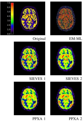 Figure 7 shows the reconstructed images obtained with the different reconstruction methods for temporal-frames t = 4 (4-6 min), t = 7 (14-18 min), and t = 14 (42-46 min).